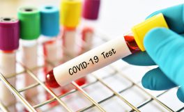 Türkiye'de coronavirüs test kiti geliştiren firmalar